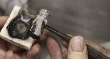 Ring being removed